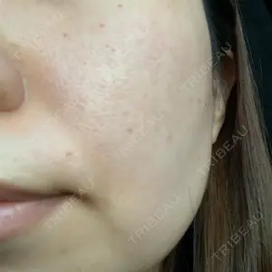 ルラ美容クリニック 大宮院 / ルラスキンクリニック 大宮院口コミ