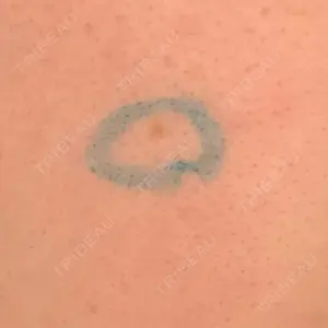 東京美容外科 沖縄院口コミ