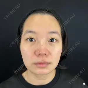 藤・ナチュレ美容クリニック 銀座院口コミ