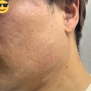 BiBiクリニック口コミ