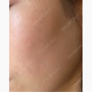 ルラ美容クリニック 郡山院口コミ