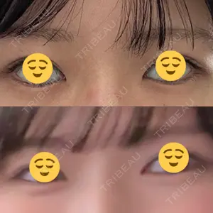 フィラークリニック 大阪心斎橋院口コミ