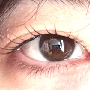 東京シンデレラ美容外科 大宮院口コミ