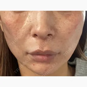 フィラークリニック 名古屋栄院口コミ