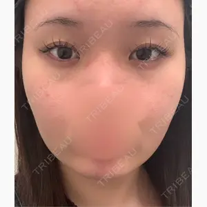 ルラ美容クリニック 名古屋栄院 / ルラスキンクリニック 名古屋栄院口コミ