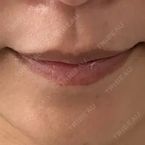 フィラークリニック 大阪梅田院口コミ