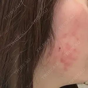 東京美容皮膚科アロエクリニック池袋口コミ