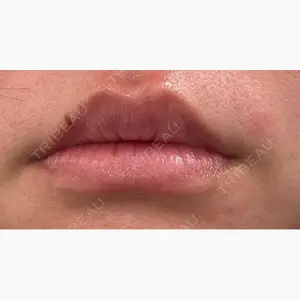 MKクリニック 日本橋院口コミ