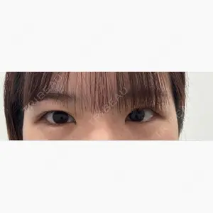 東京シンデレラ美容外科 大宮院口コミ