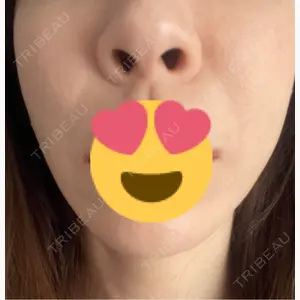 吉祥寺アイビークリニック口コミ