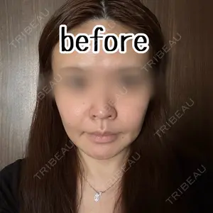 A CLINIC（エークリニック） 横浜院口コミ