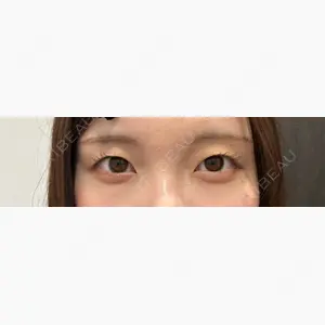 R Beauty CLINIC 大阪院口コミ
