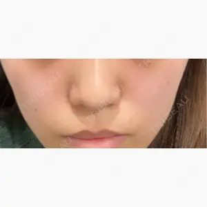 TCB東京中央美容外科 名古屋駅前院口コミ