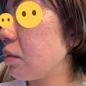 ルラ美容クリニック 池袋院口コミ