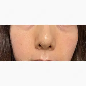 APスキンクリニック銀座口コミ