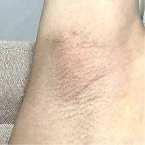 ルラ美容クリニック 渋谷本院口コミ