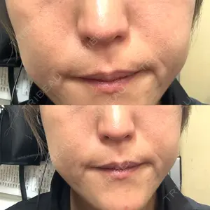 エースクリニック 大阪梅田HEPナビオ院口コミ