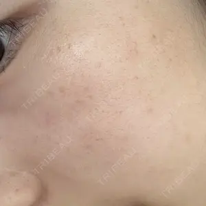 ルラ美容クリニック 神戸院口コミ