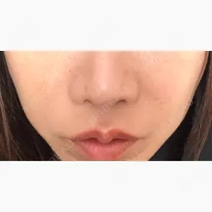 PRO CLINIC プロクリニック 銀座院口コミ