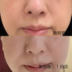 小倉美容外科/美容皮膚科 ビラビューティークリニック口コミ