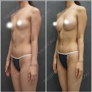 ヴェルトラクリニック 大阪院口コミ