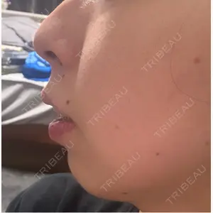 博多美容外科/美容皮膚科 ビラビューティークリニック口コミ