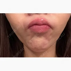 湘南美容クリニック 名古屋院口コミ