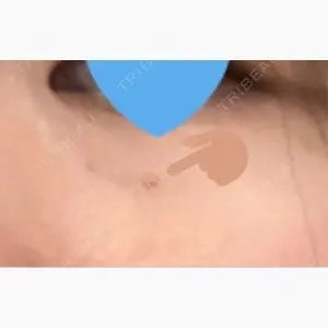 ルラ美容クリニック 新宿院口コミ