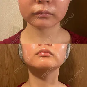 BISIN GINZA CLINIC口コミ