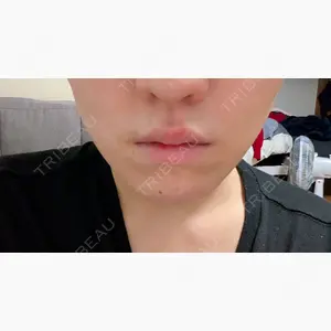 TCB東京中央美容外科 船橋院口コミ