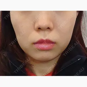 LUHO（ルホ）美容外科口コミ