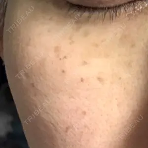 ルラ美容クリニック 町田院口コミ