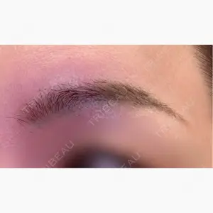 東京イセアクリニック口コミ