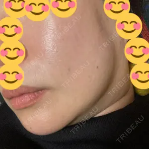 DAILY SKIN CLINIC 心斎橋院口コミ