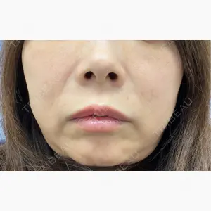 DAILY SKIN CLINIC 心斎橋院口コミ