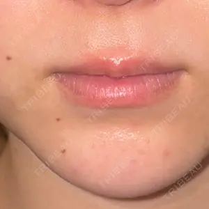 栄美容クリニック 栄院口コミ