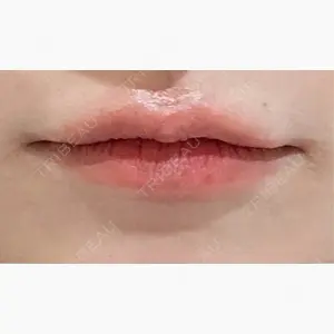 Ledian Clinic六本木口コミ