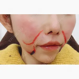 APスキンクリニック銀座口コミ