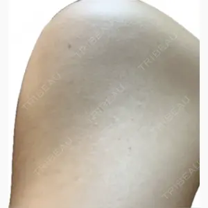 吉祥寺アイビークリニック口コミ