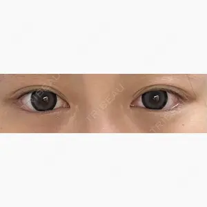 APOLLO BEAUTY CLINIC口コミ