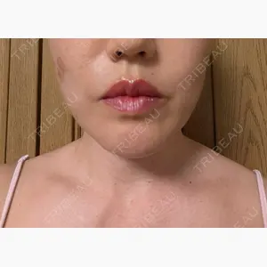 Kinshicho Beauty Clinic （錦糸町ビューティークリニック）口コミ