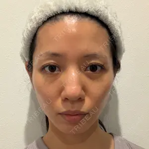 アリエル美容クリニック 水戸院口コミ