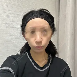 EMMO FACE CLINIC 東京三田院口コミ