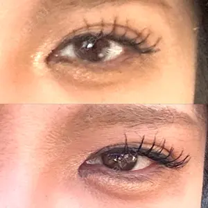 共立美容外科 京都院口コミ