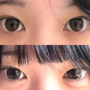 フィラークリニック 大阪心斎橋院口コミ