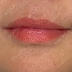 ルラ美容クリニック 静岡院口コミ