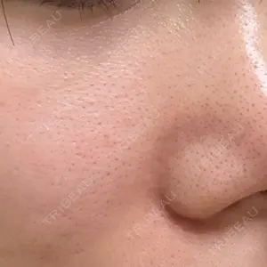 東京素肌クリニック 新宿院口コミ