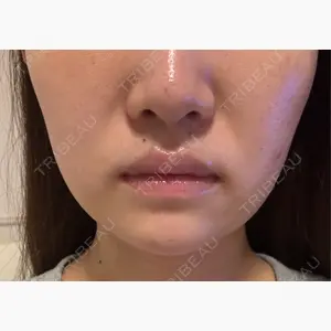 新宿美容外科ネビュラクリニック口コミ