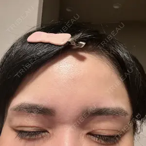 湘南美容クリニック 自由が丘院口コミ