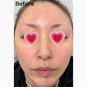 TCB東京中央美容外科 水戸院口コミ